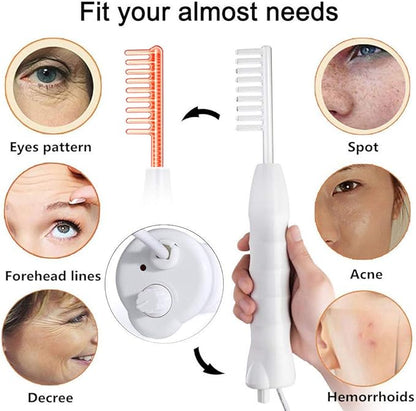 ¡Adiós Caída Cabello! TERAPIA DE ALTA FRECUENCIA.